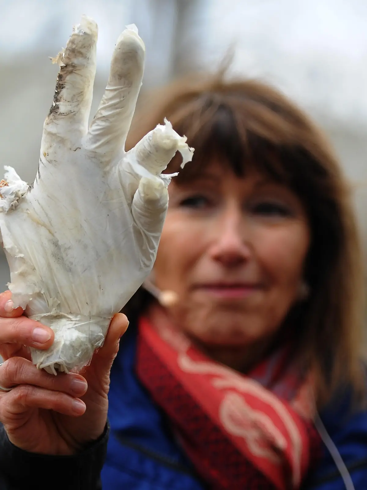 Böller zerfetzt Hand