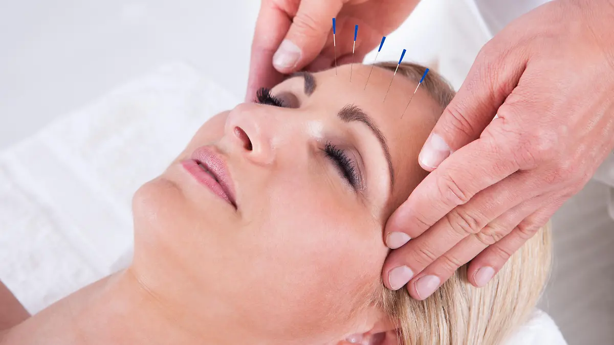 Detail Of A Woman Receiving An Acupuncture Needle Therapy