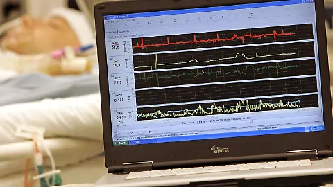 Knstliches Koma: Die Vollnarkose, die den Patienten entlastet