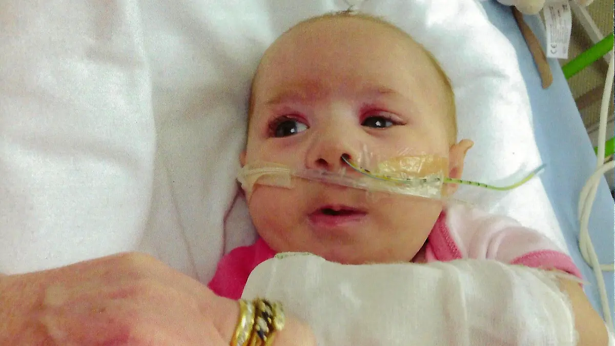 PIC FROM CATERS NEWS - (PICTURED: Jess Kerr) - Parents of a one-year-old girl bravely perform CPR on her up to FIVE TIMES every day to keep her alive. Little Jess Kerr suffers from a rare condition that cause her to FORGET to breathe and turns blues. She has battled the life-threatening condition, known as Patau syndrome, since birth and requires round-the-clock care to keep her alive. Her parents Melanie and Simon must keep oxygen close by at all times in case Jess doesnt remember to inhale she also has no immune system and is extremely prone to infections. SEE CATERS COPY.