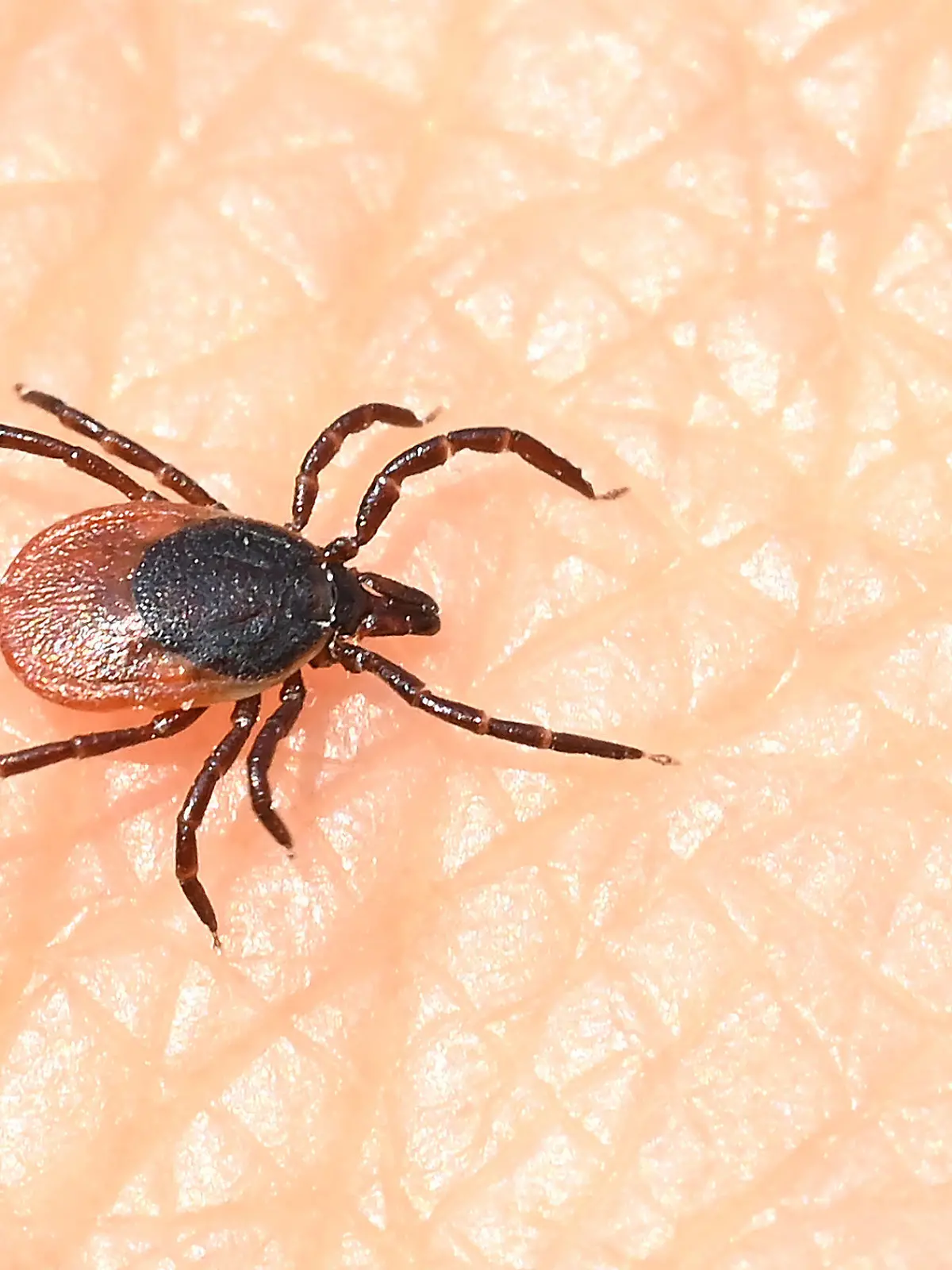 ARCHIV - 11.06.2021, Baden-Württemberg, Stuttgart: Eine Zecke läuft über eine Hand. Forschende der Universität Zürich haben das neue Alongshan-Virus nun auch in Zecken aus der Schweiz nachgewiesen. (zu dpa «Neues Virus in Schweizer Zecken entdeckt - Gefahr für Menschen unklar») Foto: Bernd Weißbrod/dpa +++ dpa-Bildfunk +++
