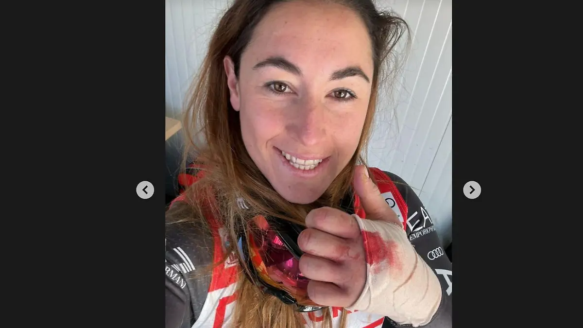 Sofia Goggia zeigt ihre blutige Hand.