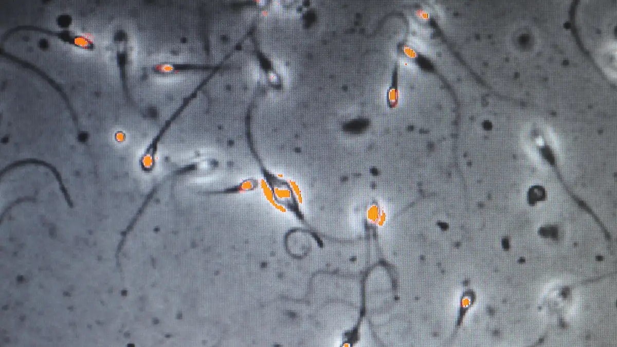 Investigating sperm quality of fertile men. Foto: LEHTIKUVA / Martti Kainulainen +++(c) dpa - Report+++