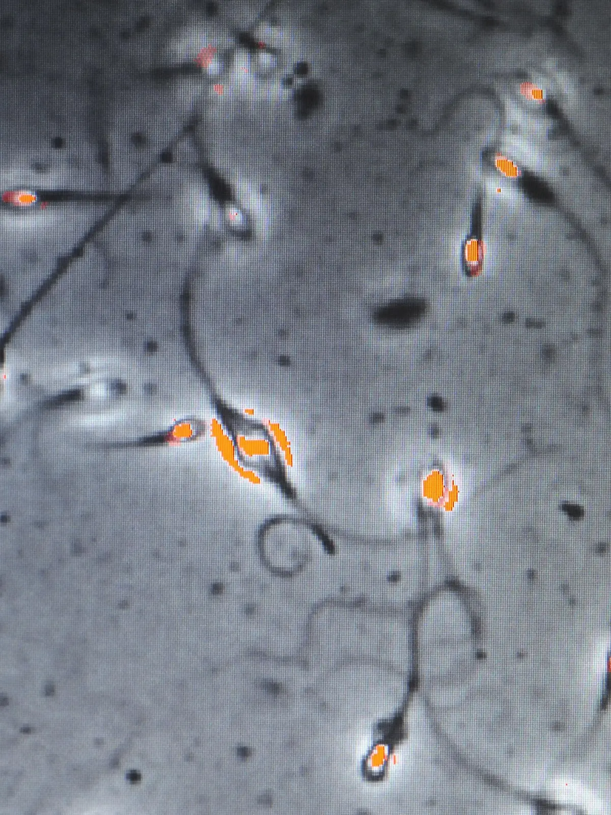 Investigating sperm quality of fertile men. Foto: LEHTIKUVA / Martti Kainulainen +++(c) dpa - Report+++