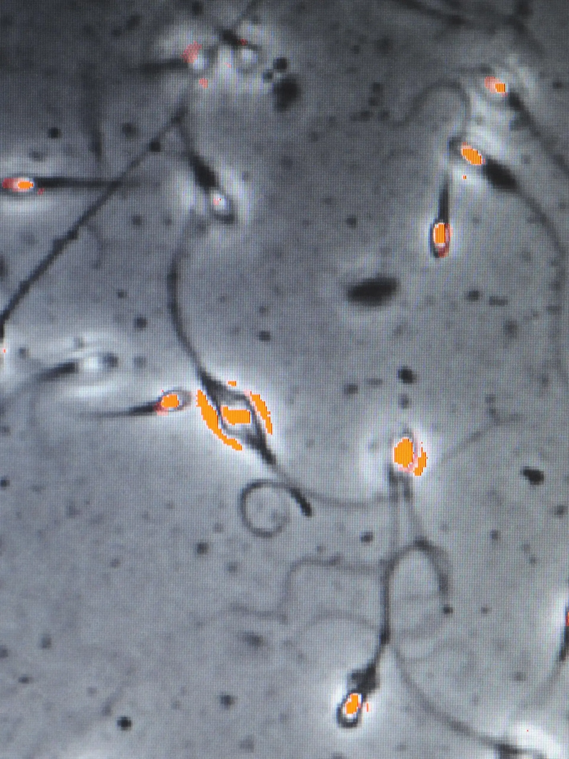 Investigating sperm quality of fertile men. Foto: LEHTIKUVA / Martti Kainulainen +++(c) dpa - Report+++
