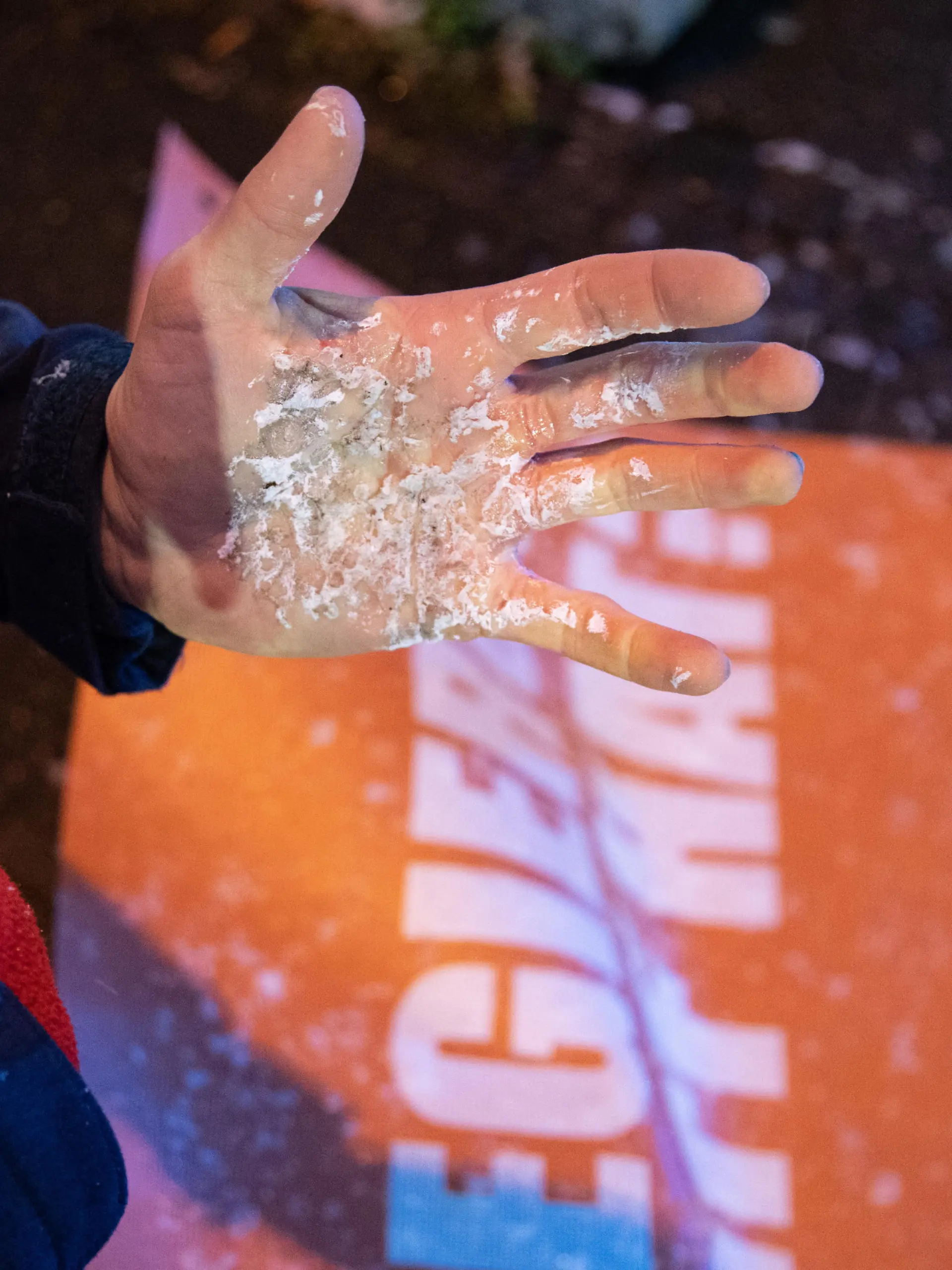 Verletzte Hand, die von Polizisten abgerissen wurde. Drei Aktivist*innen der Letzten Generation blockierten am Nachmittag des 9.12.2022 in München eine Straße gegenüber des Hauptbahnhofs, um für ein Neun-Euro-Ticket und ein Tempolimit von 100 km/h auf Autobahnen zu demonstrieren. Als die Polizei eintraf, wurden die klebenden Hände der zwei Aktivisten von Polizist*innen von der Straße gerissen. Nachdem sie auf den Gehweg getragen wurden, hielten sie dort eine kurze Versammlung ab. Im Anschluss versuchten sie wieder eine Straße zu blockieren, aber die Polizei verhinderte dies sofort. -- Injured hand that was ripped of the road while glued. Three activists of the Last Generation blocked a street in front of the main station in Munich, Germany on the afternoon of Dec. 9, 2022, to demonstrate for a 9-euro ticket and a speed limit of 100 km/h on highways. When the police arrived, the glued hands of two activists were ripped off the street by police officers. After they were carried to the sidewalk, they held a short rally there. Afterwards, they tried to block a street again, but the police immediately prevented this. / 091222