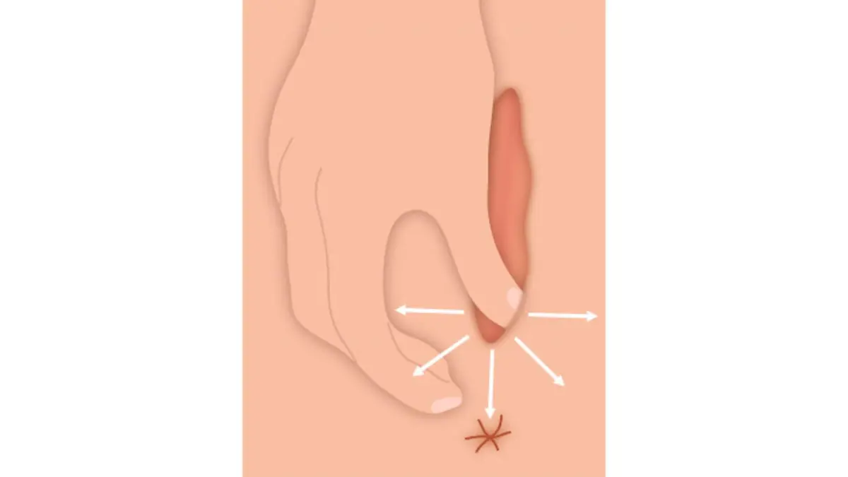 Der dritte Schritt der Dammmassage