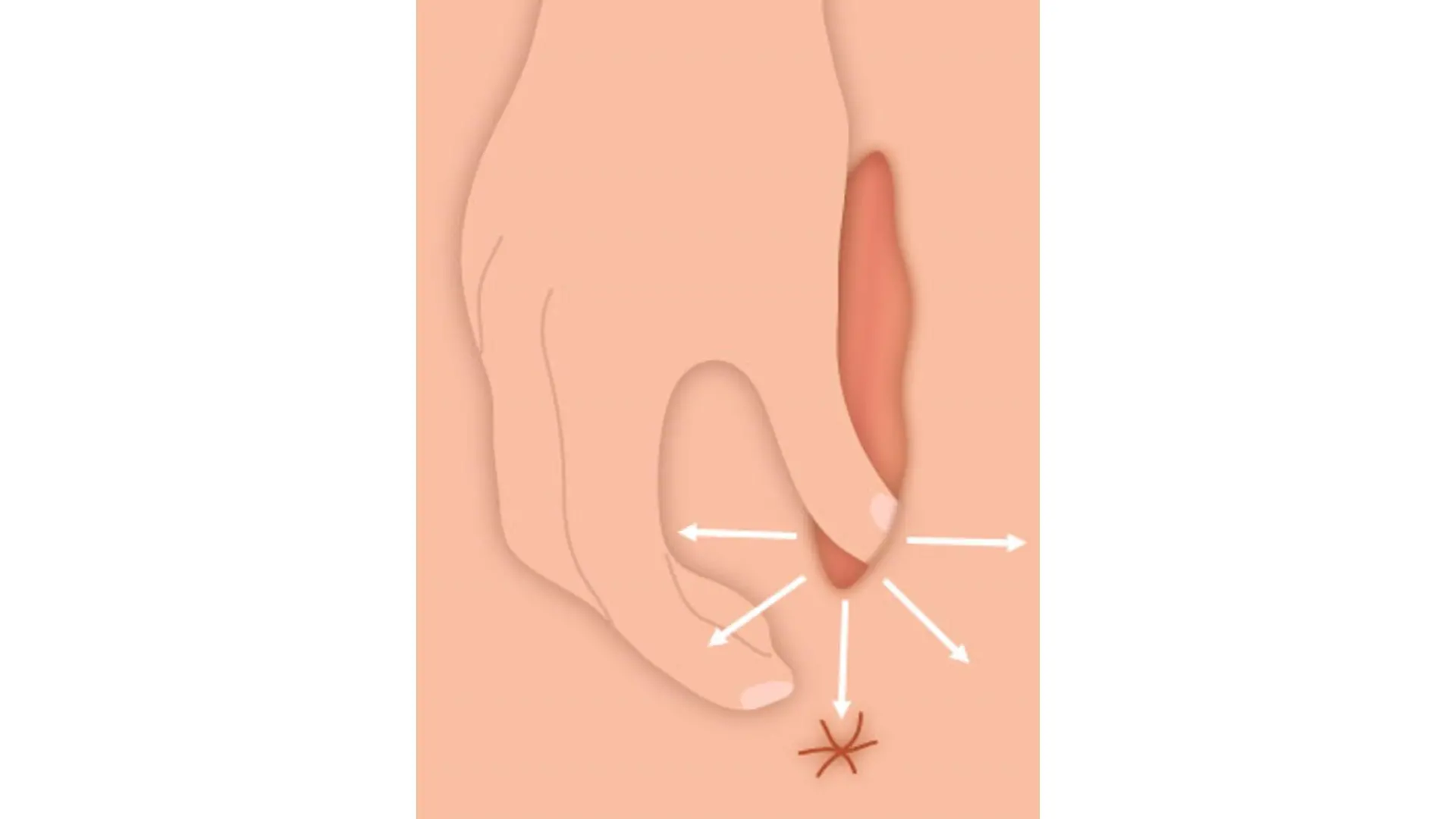 Der dritte Schritt der Dammmassage