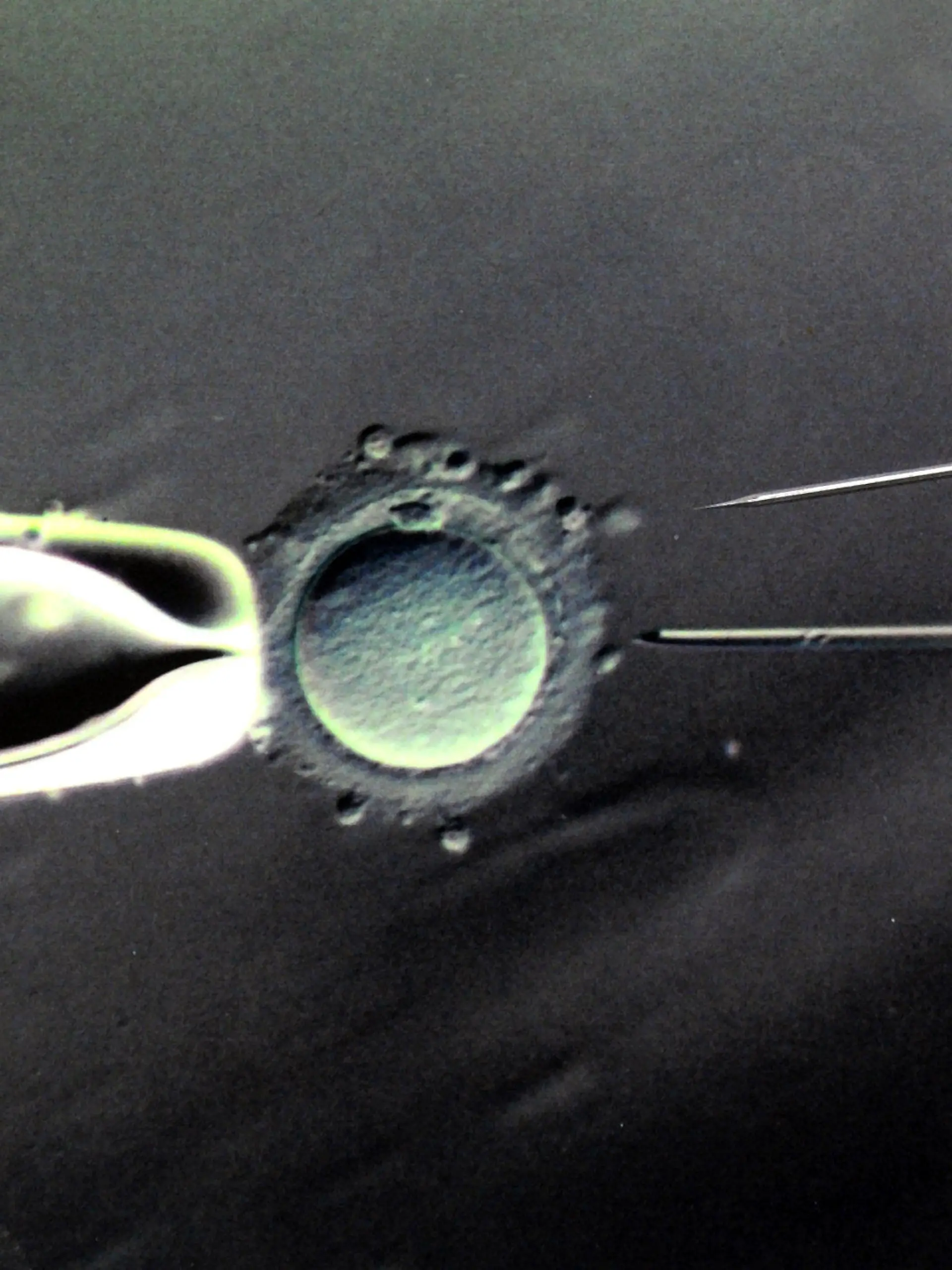 ARCHIV - Im Biologischen Labor des Zentrums für Reproduktionsmedizin an der Universitätsfrauenklinik in Leipzig ist eine 80- bis 100-fache Vergrößerung der Befruchtung einer Eizelle mit einer Injektionspipette und eine darüber liegende Injektionspipette mit einem Durchmessser von 5 Mikrometer in Originalgröße zu sehen, aufgenommen am 17.03.2011. Weltweit haben nach Expertenschätzungen zwischen 10 und 20 Prozent der Paare Probleme bei der Fortpflanzung. Medizinern stehen heute mehrere Verfahren zur Verfügung, um zu helfen. Weil die Erfolgsaussichten relativ gering sind, sind pro Paar meistens mehrere Versuche nötig. Foto: Waltraud Grubitzsch dpa (zu dpa-Themenpaket «30 Jahre Retortenbaby»)  +++(c) dpa - Bildfunk+++