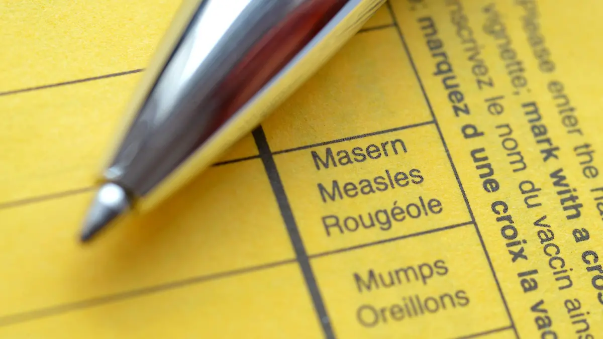 Impfbuch, Masern, Mumps Impfbuch Masern Mumps
Impfbuch Measles Impfbuch Measles