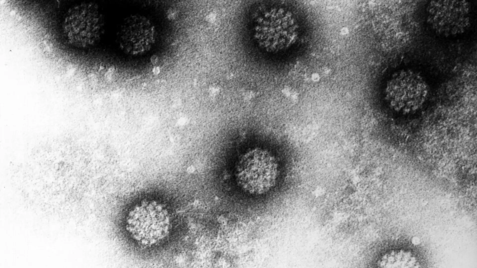 Elektronenmikroskopische Aufnahme mehrerer Humaner Papillomviren (HPV, undatiertes Handout). Der Nobelpreis für Medizin geht in diesem Jahr unter anderem an den Heidelberger Krebsforscher Harald zur Hausen. Das teilte das Karolinska-Institut am Montag (06.10.2008) in Stockholm mit. Zur Hausen erhält eine Hälfte der Ehrung für die Entdeckung der Papillomviren, die Gebärmutterhalskrebs auslösen können. Dies hat inzwischen zu einem Impfstoff gegen diesen Tumor geführt. Zur Hausen habe sich mit seiner Idee, dass Viren den Krebs auslösen können, gegen das geltende Dogma gewandt, begründete die Nobelstiftung ihre Wahl. Gebärmutterhalskrebs ist weltweit der zweithäufigste Krebs bei Frauen. Foto: Deutsches Krebsforschungszentrum dpa/lsw (zu dpa 0340 vom 06.10.2008) +++(c) dpa - Report+++