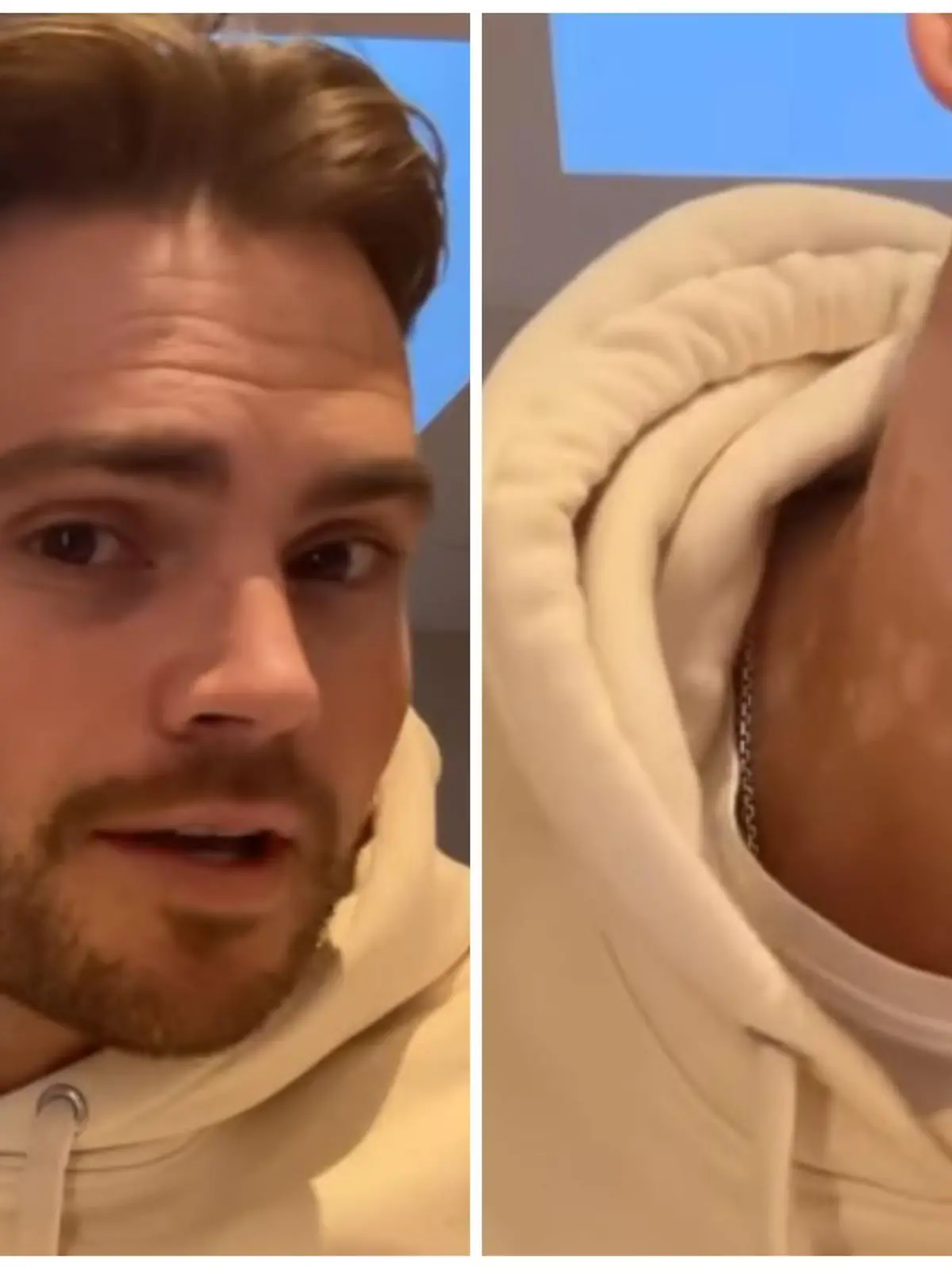 Johannes Haller klagt über Flecken am Hals.