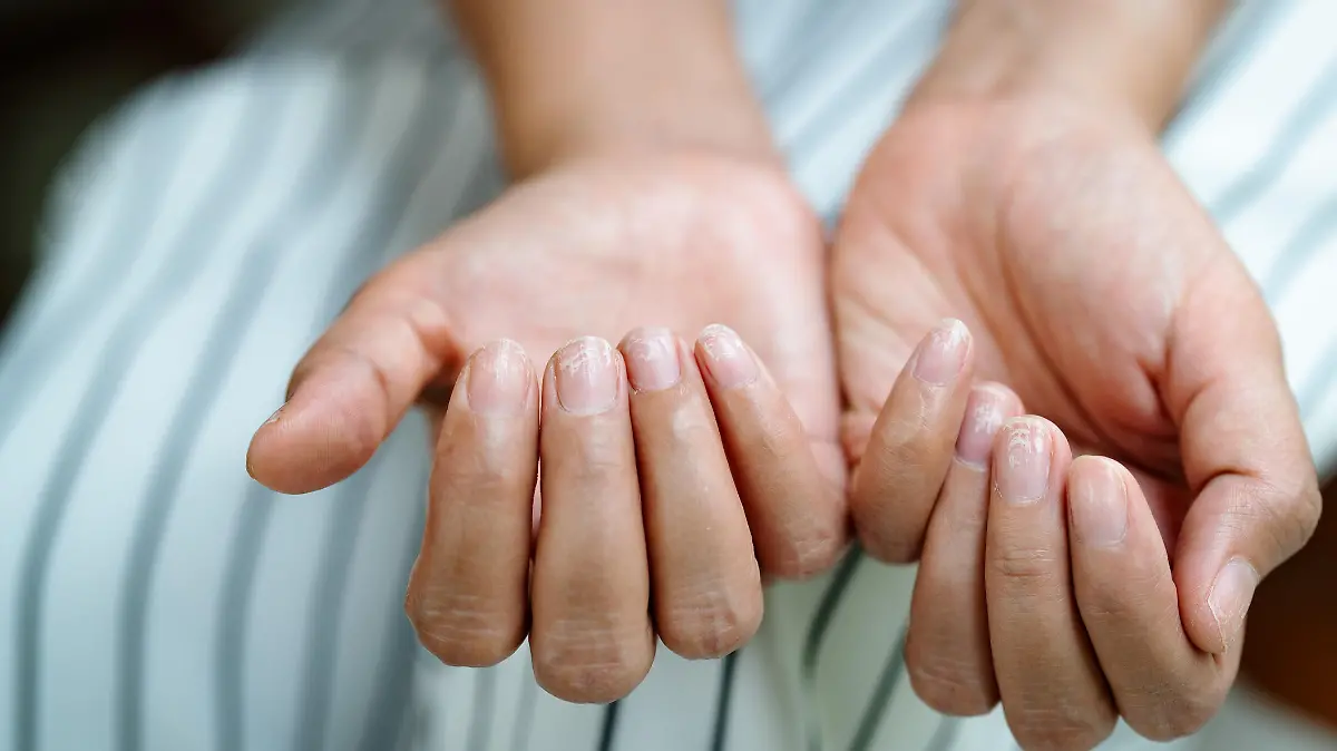 Fingernägel