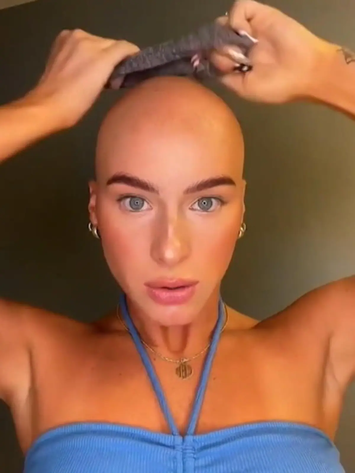 Als Kind gemobbt – heute TikTok-Star! Chloe Bean hat keinen leichten Start ins Leben: Mit acht Jahren wird bei der Amerikanerin kreisrunder Haarausfall diagnostiziert. Fortan versucht sie ihre kahlen Stellen mit Hüten zu verstecken – bis sie selbst die Kontrolle übernimmt und sich eine Glatze rasiert. Ein Befreiungsschlag! Heute ist die 23-Jährige Beauty-Unternehmerin und ein Vorbild für 1,3 Millionen TikTok-Follower.