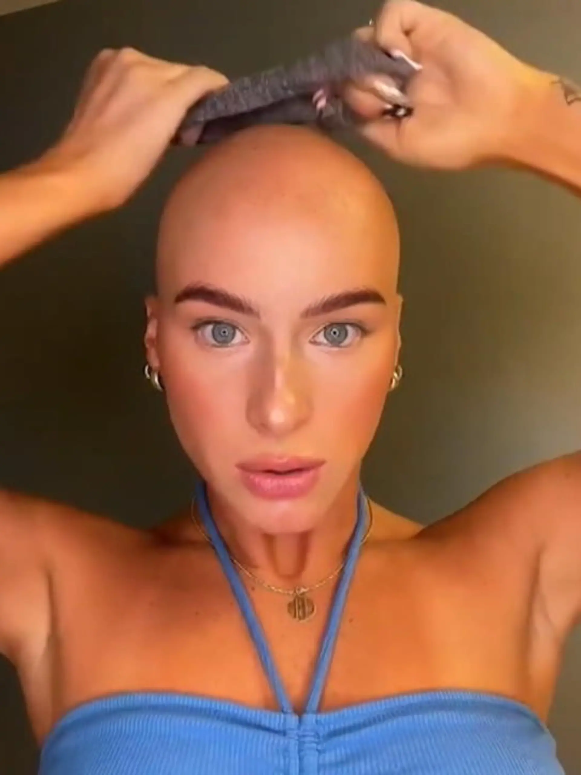 Als Kind gemobbt – heute TikTok-Star! Chloe Bean hat keinen leichten Start ins Leben: Mit acht Jahren wird bei der Amerikanerin kreisrunder Haarausfall diagnostiziert. Fortan versucht sie ihre kahlen Stellen mit Hüten zu verstecken – bis sie selbst die Kontrolle übernimmt und sich eine Glatze rasiert. Ein Befreiungsschlag! Heute ist die 23-Jährige Beauty-Unternehmerin und ein Vorbild für 1,3 Millionen TikTok-Follower.