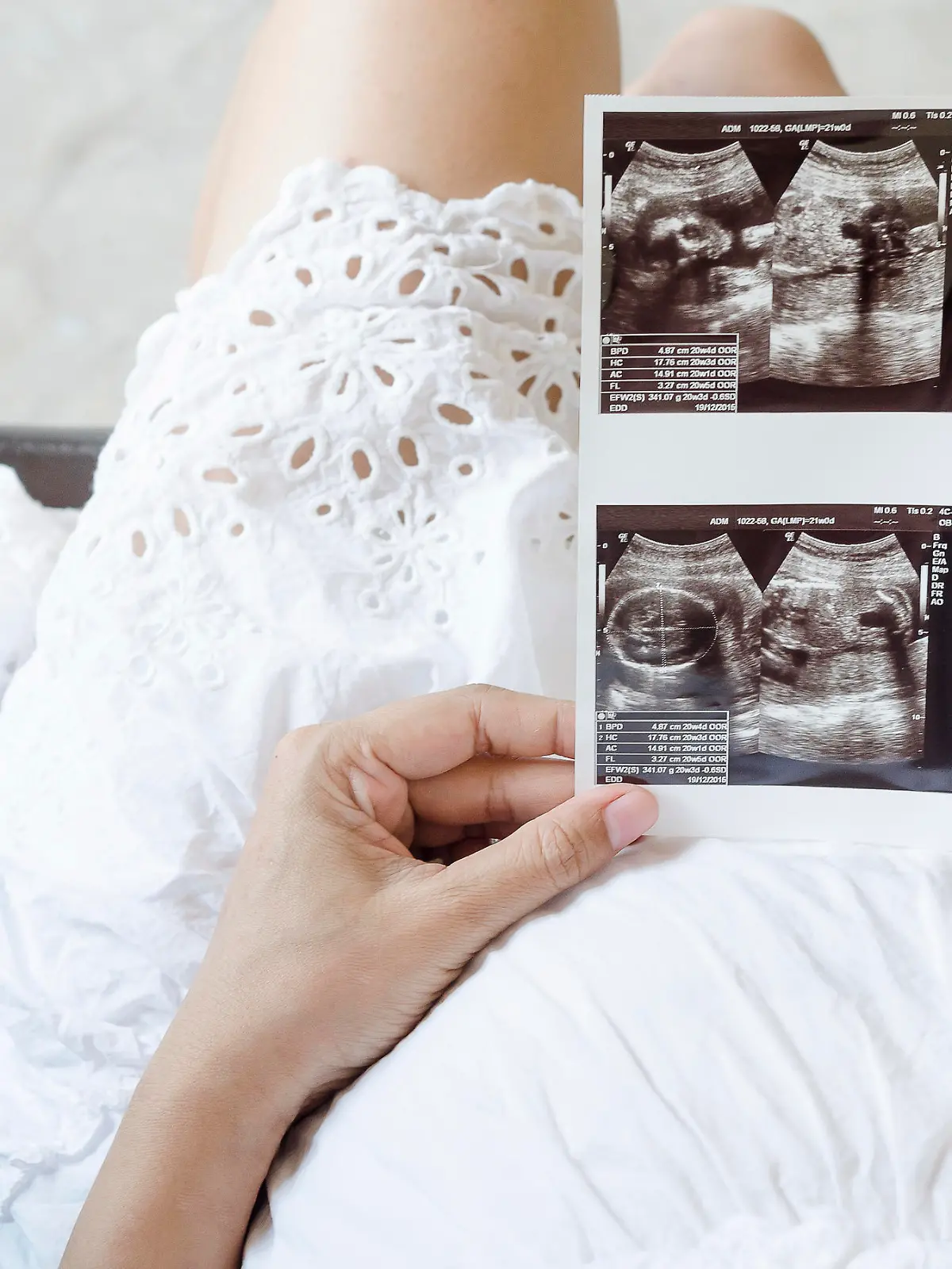 Close up of pregnant woman holding ultrasound scan