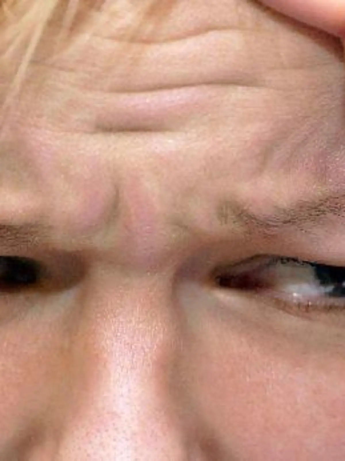 Ein junge Frau mit starken Kopfschmerzen. (Aufnahme vom 17.1.2003).