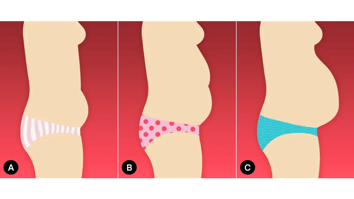 Bauch-Typen bei Frauen: Das Bäuchlein, der Rettungsring-Bauch, der Schwangerschafts-Bauch