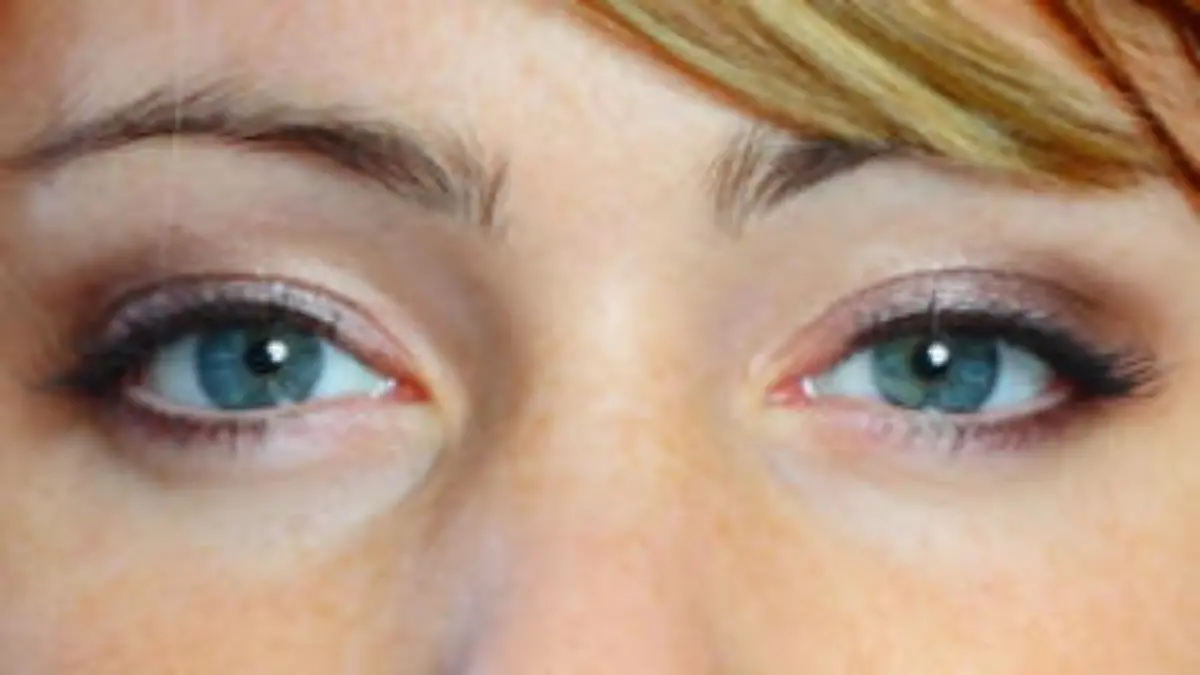 Botox bei Migräne Kopfschmerzen wegspritzen