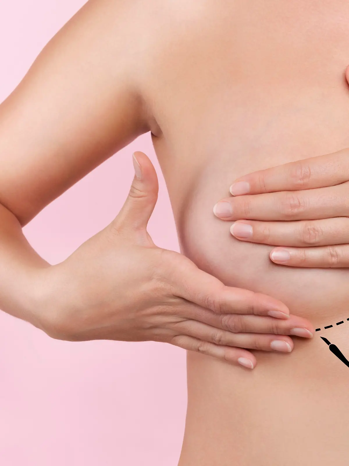 Breast augmentation. Plastic surgery and Aesthetic medicine. Beautiful woman gently touching her breast with marked dotted line ready for surgery. Breast augmentation.
