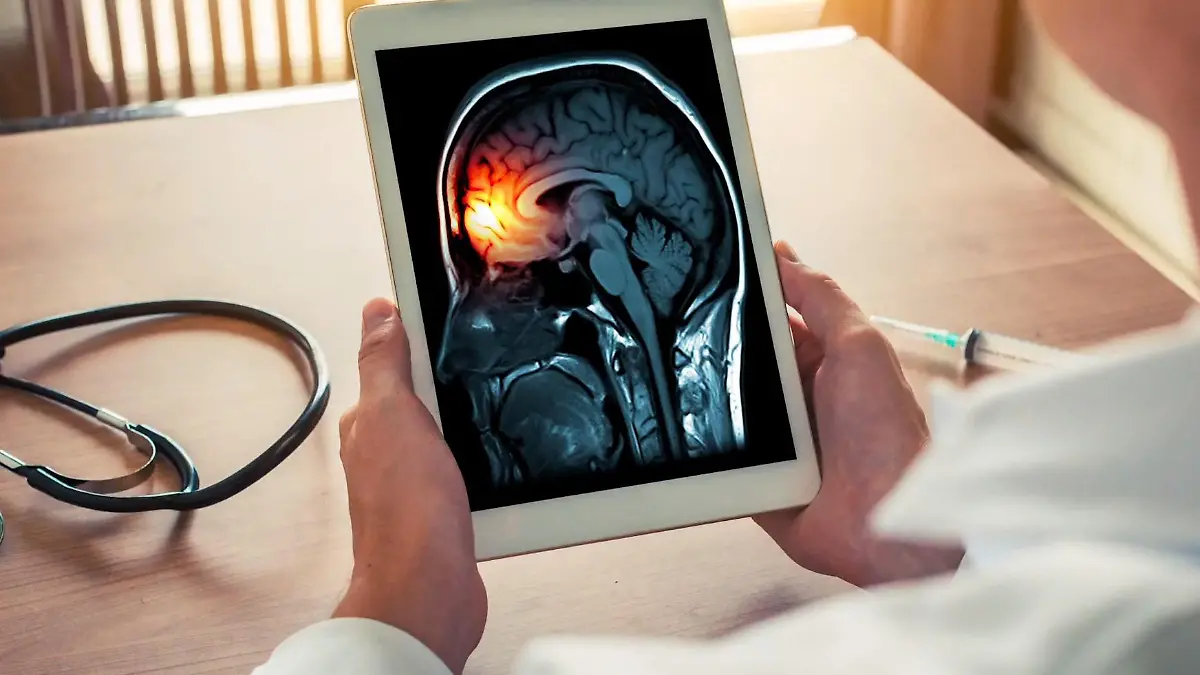 Was ist eine Meningitis? Hirnhautentzündung