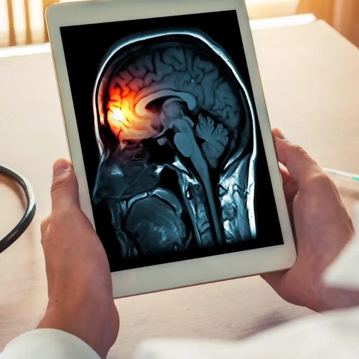 Hirnhautentzündung (Meningitis) Logo von Hirnhautentzündung (Meningitis)