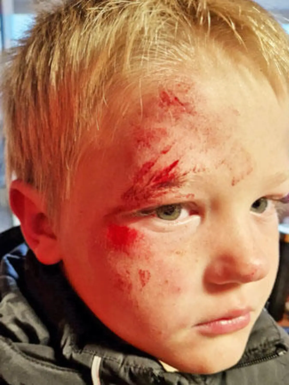 Jayden (7) spielte das "Mach mich rot"-Spiel, eine Art Variante der Blackout Challenge, und verletzte sich dabei schwer.