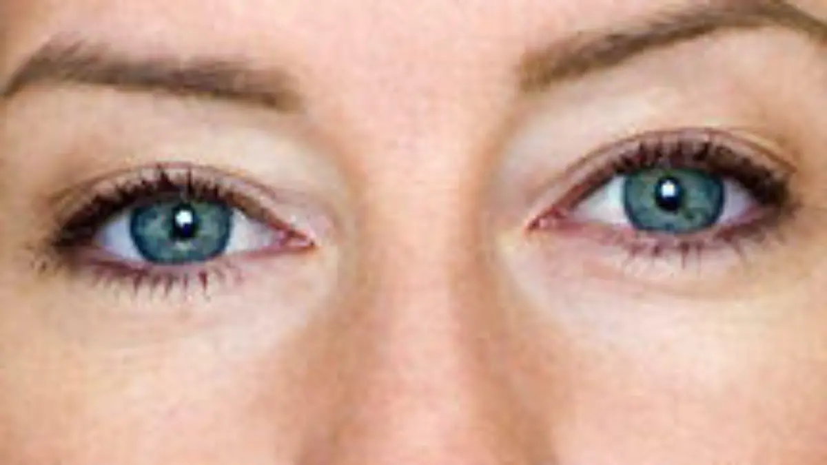 uu augen quiz10 i