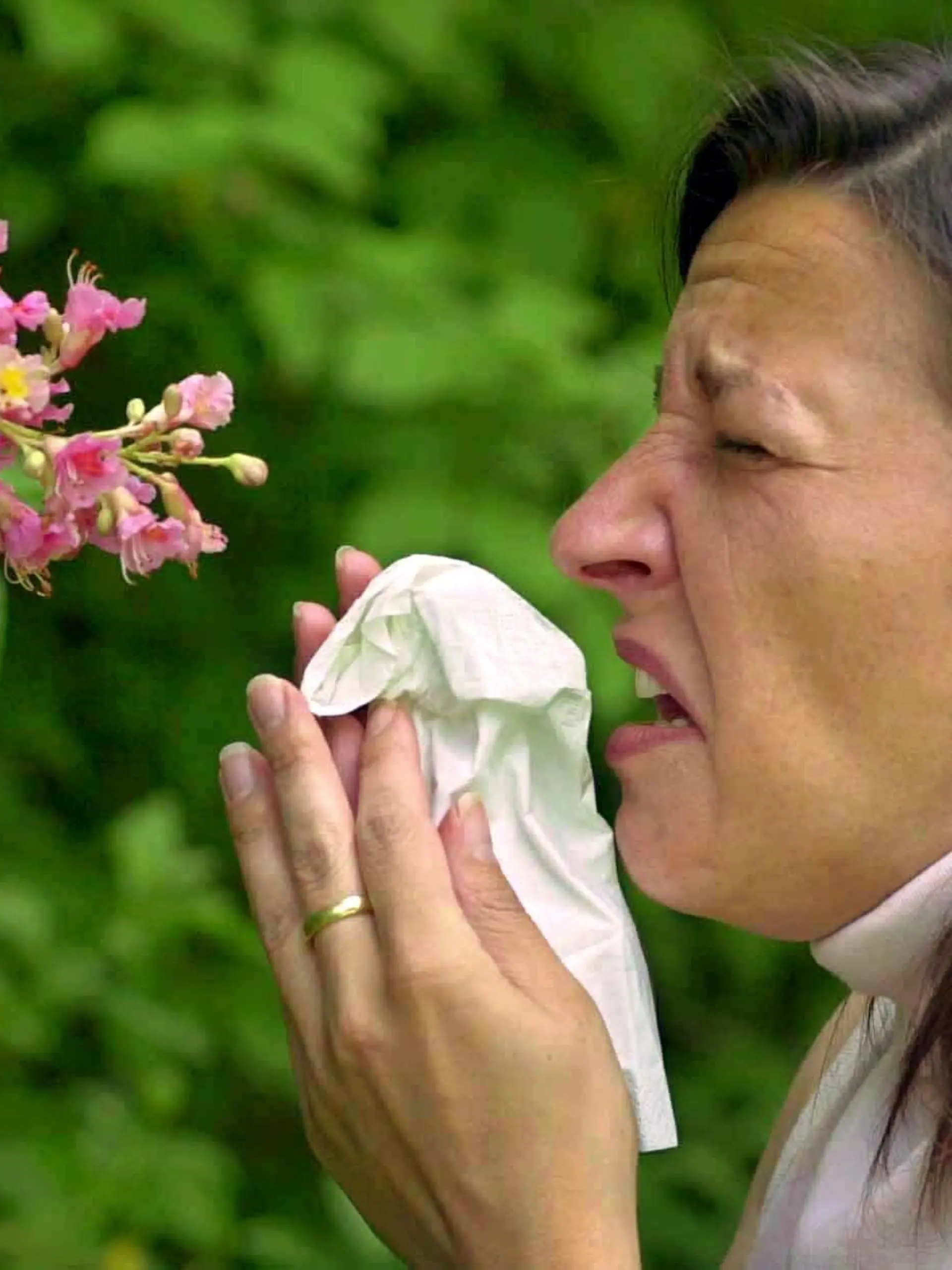 Eine junge Frau in einer Grünanlage in Würzburg muss vor einer Kastanienblüte niesen (Symbolbild vom 6.5.2003). Das anhaltend trockene Wetter führt zur Zeit zu einem ungewöhnlich starken Pollenflug, der besonders Allergikern Probleme bereitet. Nach Beobachtung der Deutschen Gesellschaft für Allergologie und Immunologie nehmen Allergie-Beschwerden deutlich zu. Möglicherweise sei eine veränderte Pollenstruktur für den Anstieg verantwortlich, hieß es. Die Pollen-Allergien treffen demnach auch eine neue Gruppe von Patienten: bisher beschwerdefreie, ältere Menschen. Auffallend viele Patienten litten zudem deutlich stärker an Allergie-Beschwerden.