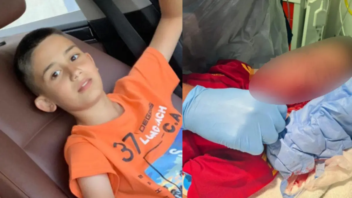 Blutige Hunde-Attacke