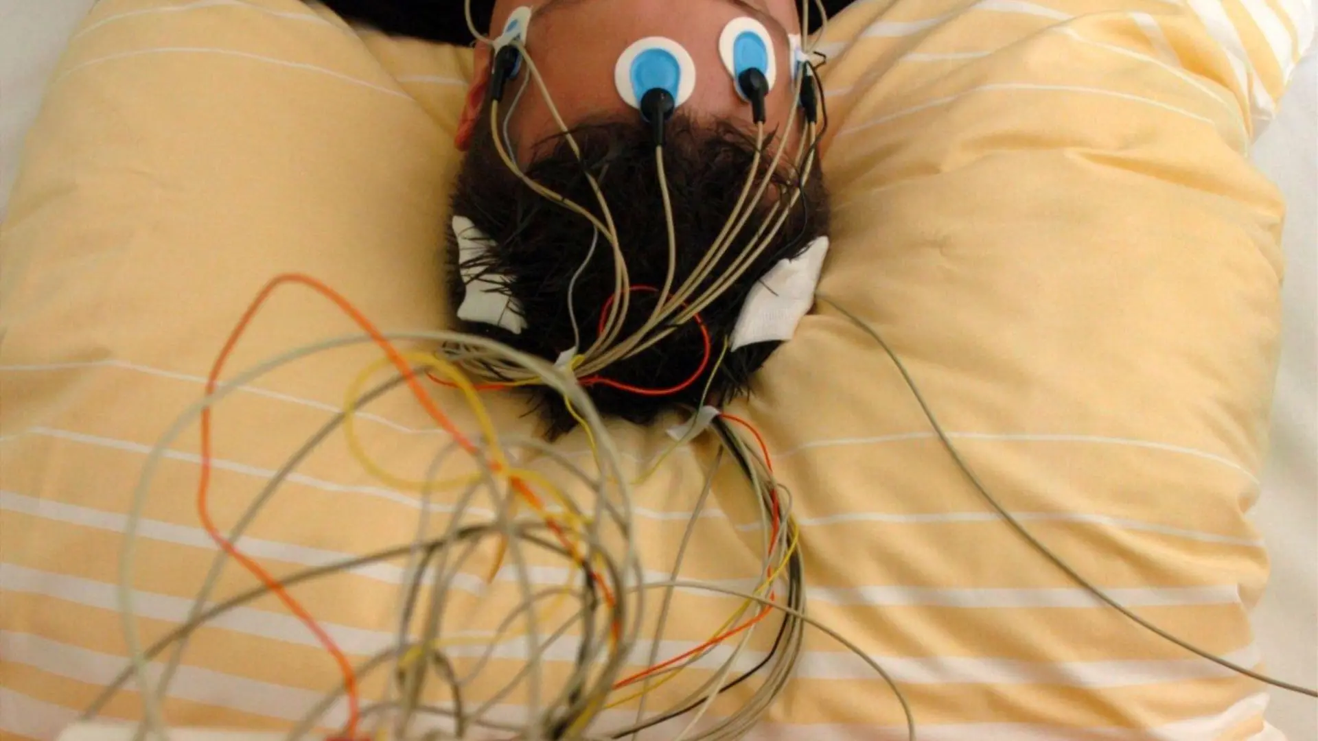 Ein Patient des Schlaflabors der Universitätsklinik Freiburg liegt, am Kopf mit Elektroden bestückt, in einem Bett der Einrichtung (Foto vom 22.09.2004). Kabel leiten die gemessenen Hirnströme an ein Aufzeichnungsgerät weiter. Rund 800 Schlafforscher und -mediziner aus Deutschland, der Schweiz und Österreich diskutieren noch bis Samstag (25. September) im Rahmen der 12. Jahrestagung der Deutschen Gesellschaft für Schlafforschung und Schlafmedizin (DGSM) neueste Erkenntnisse rund um das Kongressmotto «Schlaf und Gehirn». Ziel der DGSM ist, die Aus-und Weiterbildung in der Schlafmedizin zu etablieren. Momentan gibt es in Deutschland rund 300 Schlaflabore, die von der DGSM anerkannt sind. Sie dienen der Untersuchung verschiedener Schlafstörungen. Foto: Rolf Haid dpa/lsw (zu dpa-Korr: "Mediziner: Schlafen dient der Problemlösung und fördert Einsicht" vom 24.09.2004)