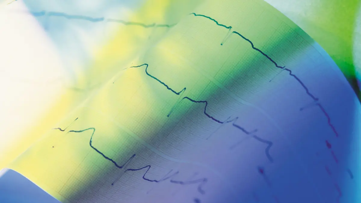 Ein EKG wird erstellt