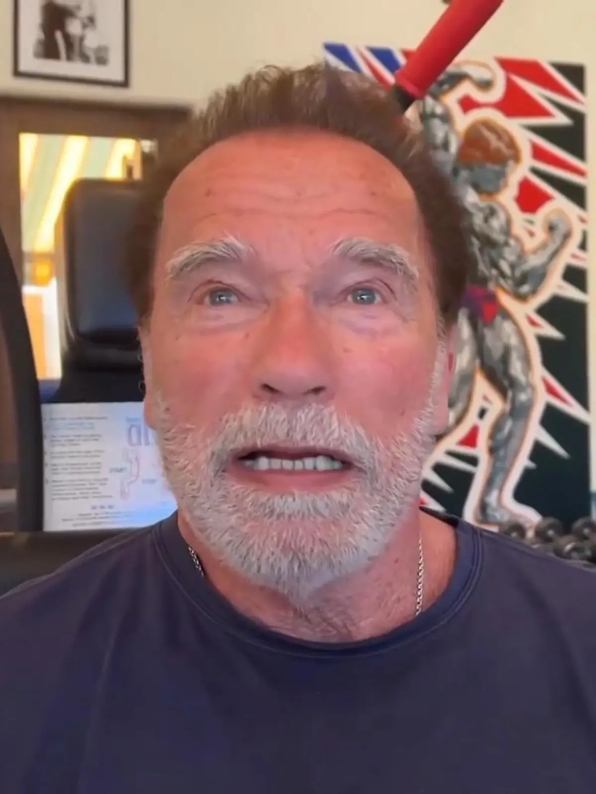 Arnie wäre bei OP fast gestorben.
