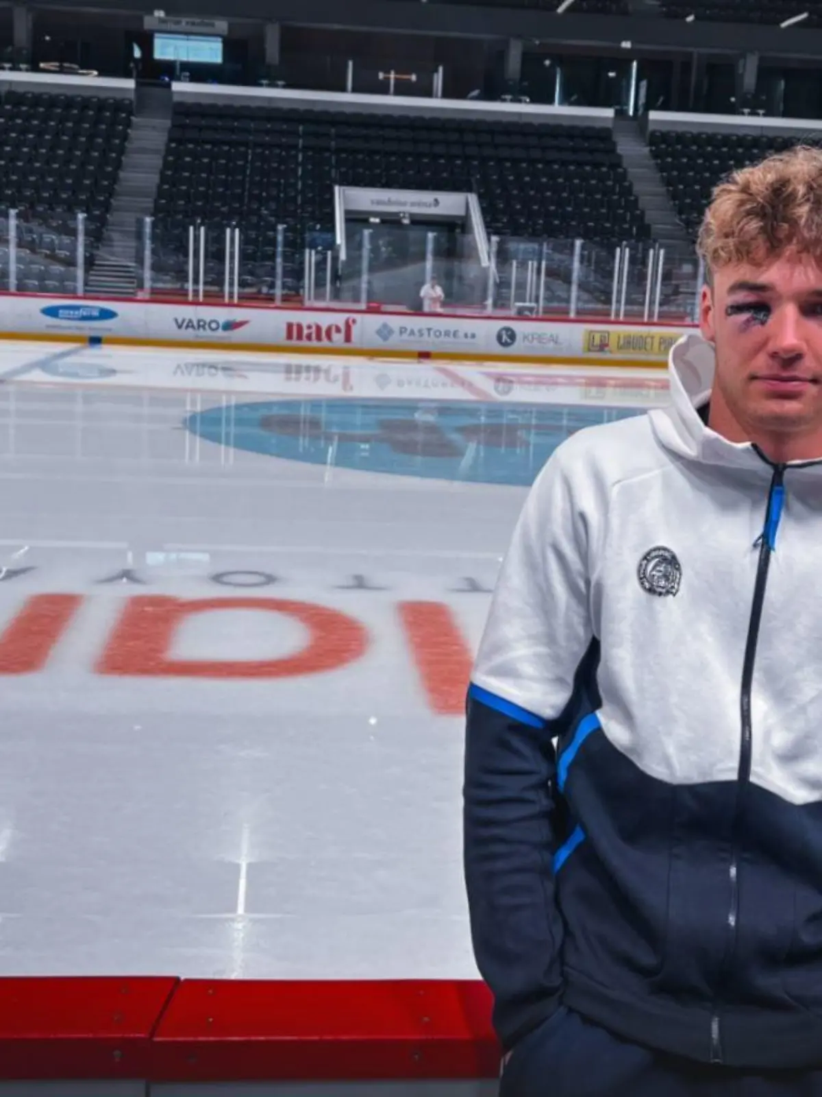 Daniel Kral erlebte einen Schockmoment. Ein Puck durchdrang das Gitter seines Helmes, traf ihn direkt am rechten Auge.