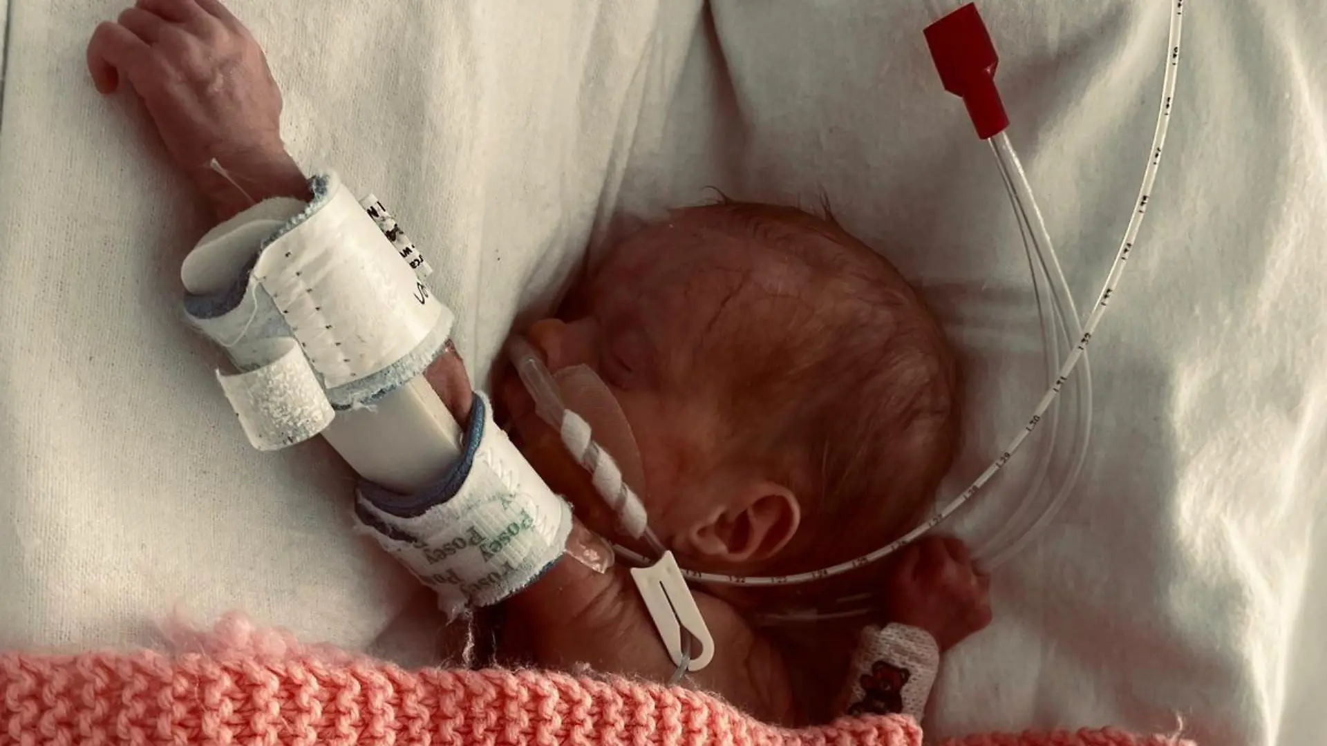 SONDERKONDITIONEN: Satzpreis!
Marley in hospital. See SWNS story SWFTMilk; A premature baby born so small she was unable to drink her mother's milk has made a miracle recovery just in time for Christmas. Little Marley, who weighed just 750g, was totally dwarfed by her octopus toy but now towers over the fluffy sea creature. New mum, Sophie Louise James, 30, was just 25 weeks pregnant, when her waters broke in April 2022. Doctors at Doncaster Hospital, Doncaster attempted to keep the baby inside Sophie's womb for as long as possible- but just four days later, Sophie went into labour and gave birth to a tiny Marley naturally. The new-born arrived on 2nd April 2022 at 5.57am and weighed so little that doctors feared she wouldn't make it. Marley was whisked straight to NICU where medics battled against a complex list of health issues, including; renal failure, a bleed on the brain, dangerous calcium levels. But after 102 days in hospital battling back to health, Marley, now seven-months-old, and weighing 9lb 9oz, was allowed home and is now thriving. The family have planned to go ''all out'' for Christmas this year to celebrate their miracle baby. / action press