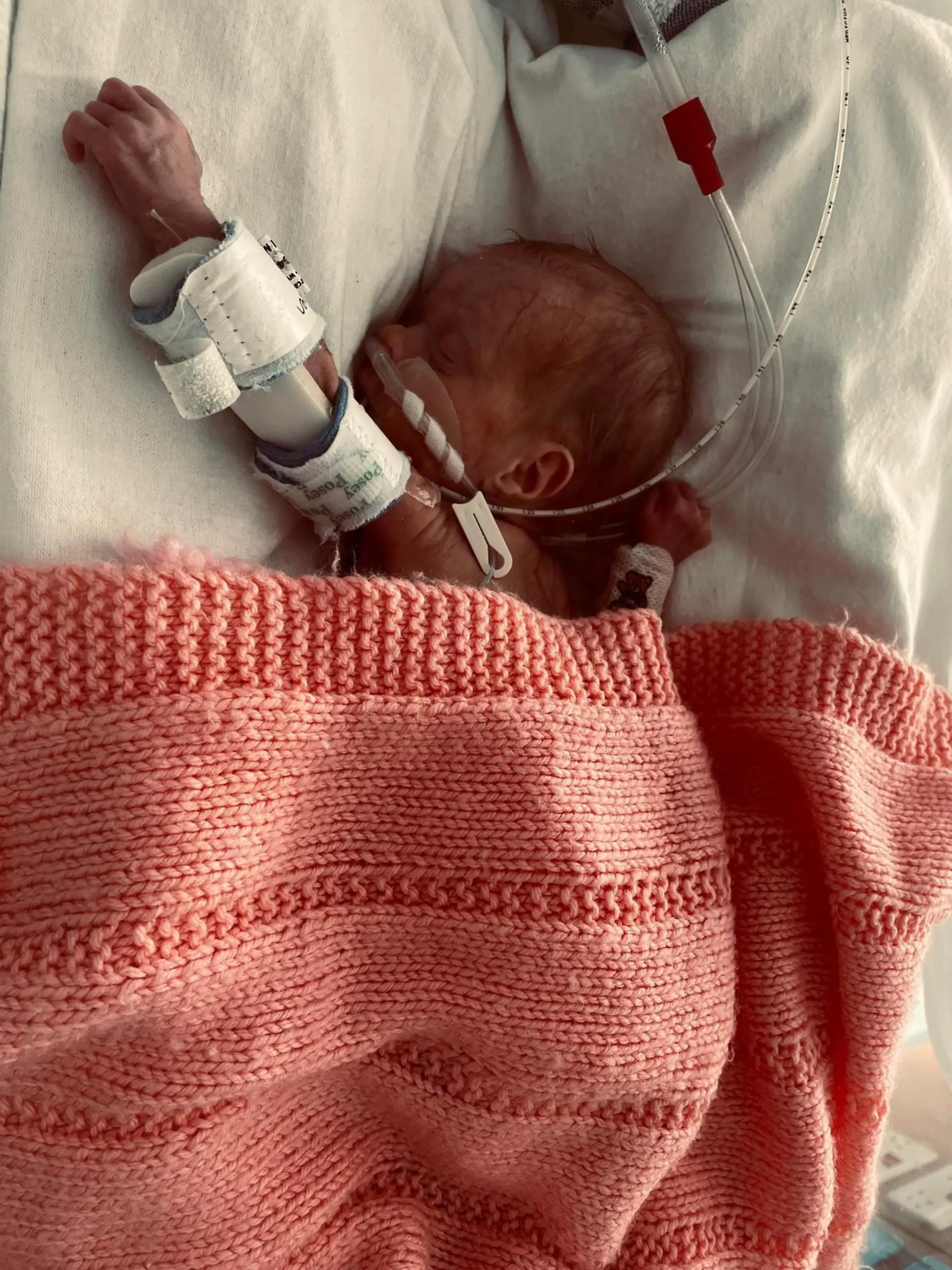 SONDERKONDITIONEN: Satzpreis!
Marley in hospital. See SWNS story SWFTMilk; A premature baby born so small she was unable to drink her mother's milk has made a miracle recovery just in time for Christmas. Little Marley, who weighed just 750g, was totally dwarfed by her octopus toy but now towers over the fluffy sea creature. New mum, Sophie Louise James, 30, was just 25 weeks pregnant, when her waters broke in April 2022. Doctors at Doncaster Hospital, Doncaster attempted to keep the baby inside Sophie's womb for as long as possible- but just four days later, Sophie went into labour and gave birth to a tiny Marley naturally. The new-born arrived on 2nd April 2022 at 5.57am and weighed so little that doctors feared she wouldn't make it. Marley was whisked straight to NICU where medics battled against a complex list of health issues, including; renal failure, a bleed on the brain, dangerous calcium levels. But after 102 days in hospital battling back to health, Marley, now seven-months-old, and weighing 9lb 9oz, was allowed home and is now thriving. The family have planned to go ''all out'' for Christmas this year to celebrate their miracle baby. / action press