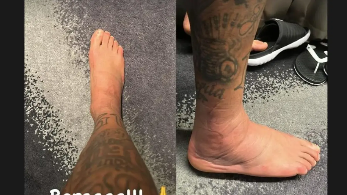 Dicker Knöchel von Neymar.