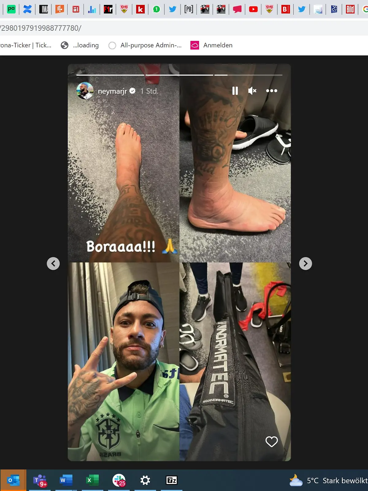 Dicker Knöchel von Neymar.