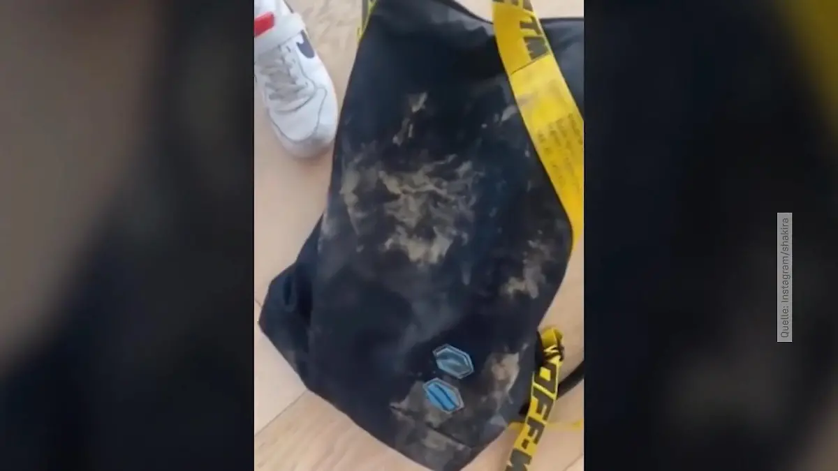 Sängerin Shakira im Park von Wildschweinen attackiert Rucksack zerstört