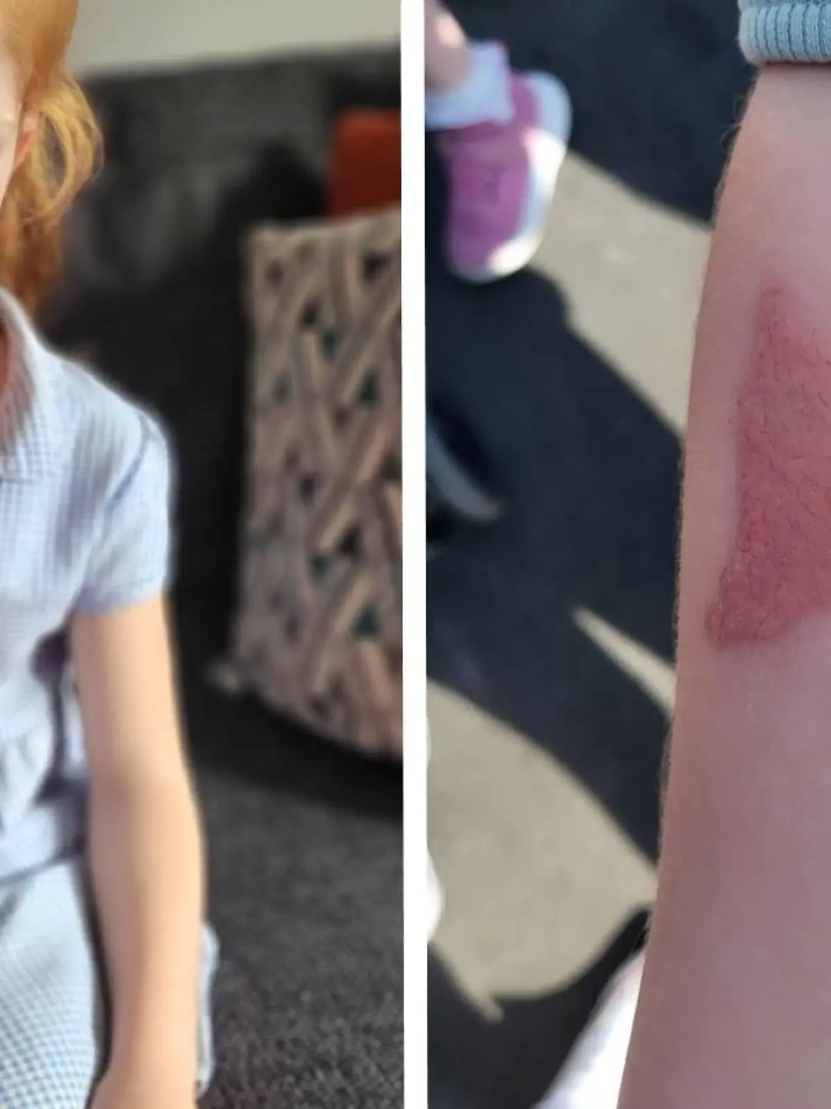 Matilda (7) hat allergische Reaktion auf Henna-Tattoo. Mutter Kirsty Newton warnt nun.
