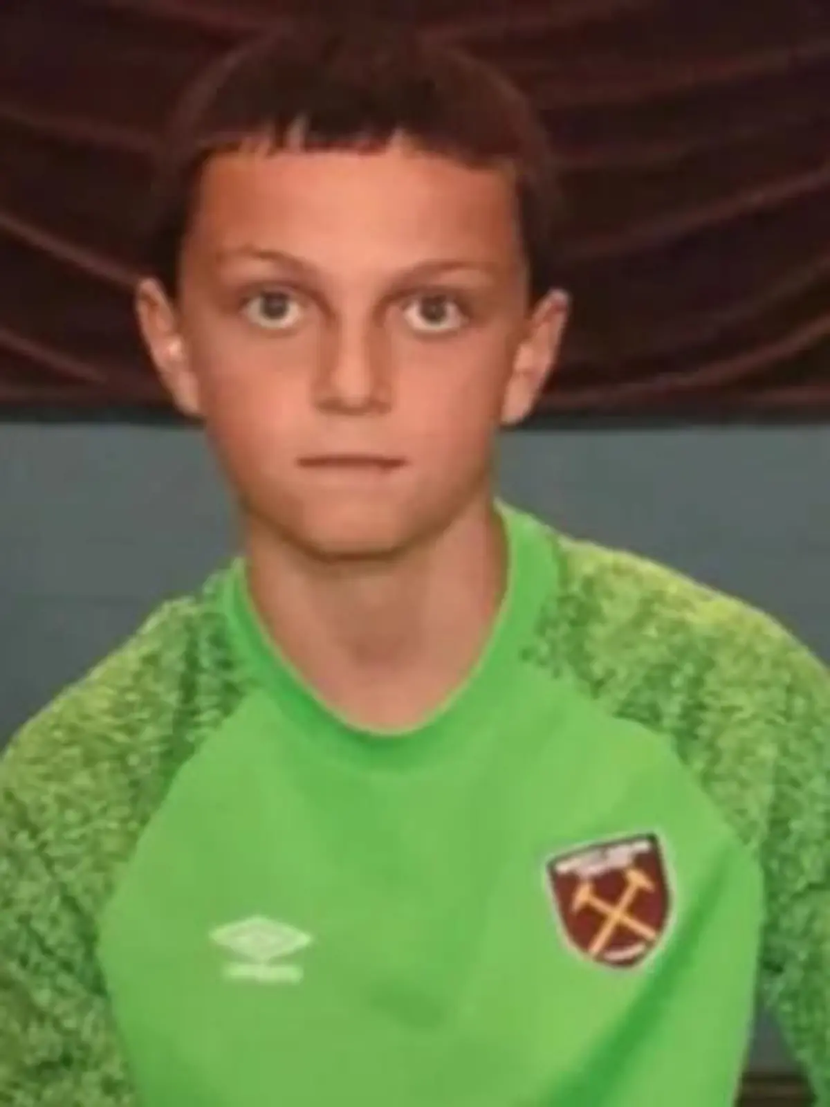 Jugendspieler Oscar Fairs von West Ham United hatte einen Hirntumor.