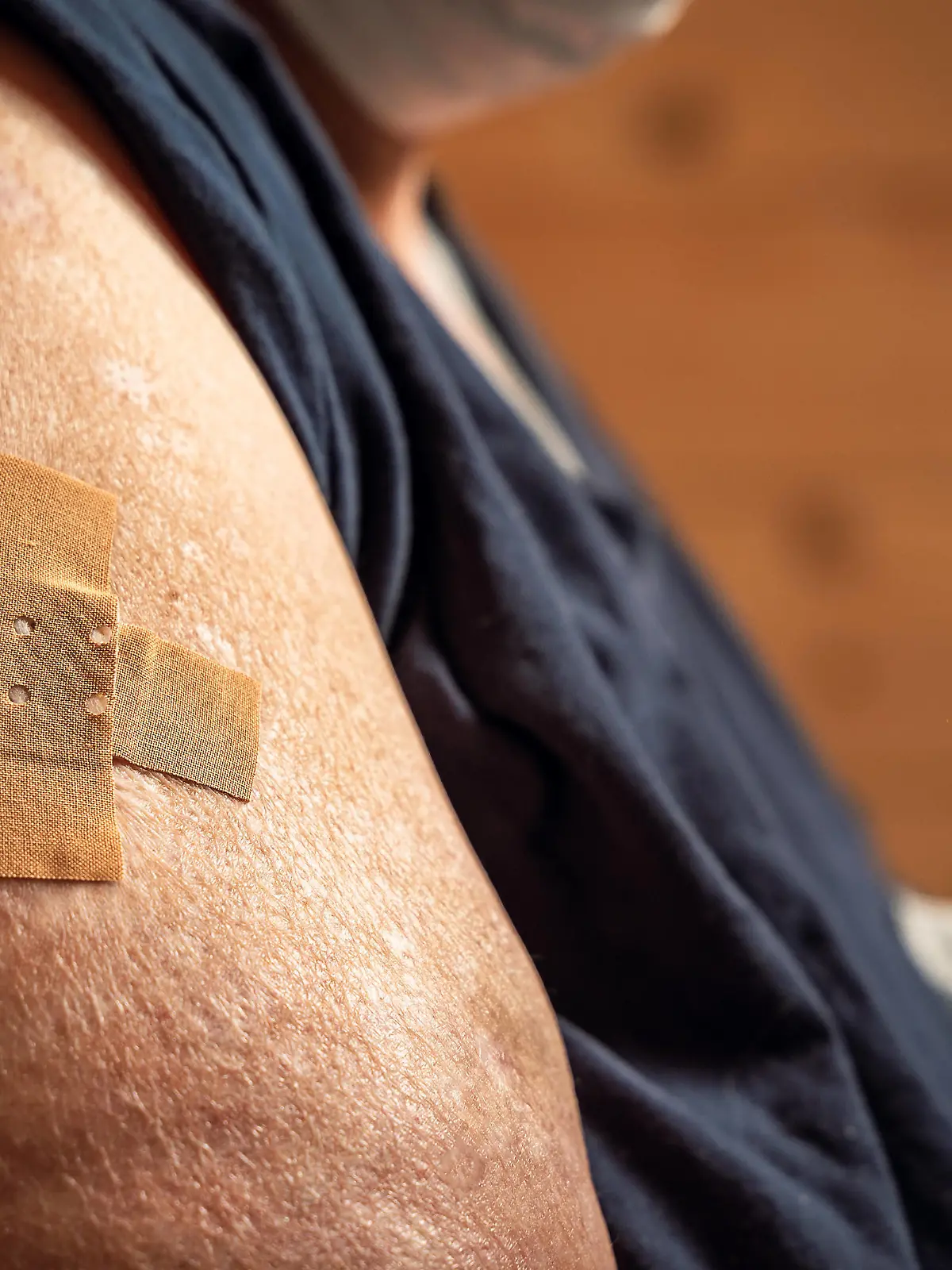  Mindelheim, Bavaria, germany - 01 may 2021: overweight woman shows her arm after being vaccinated. arm with adhesive bandage after injection. Health concept