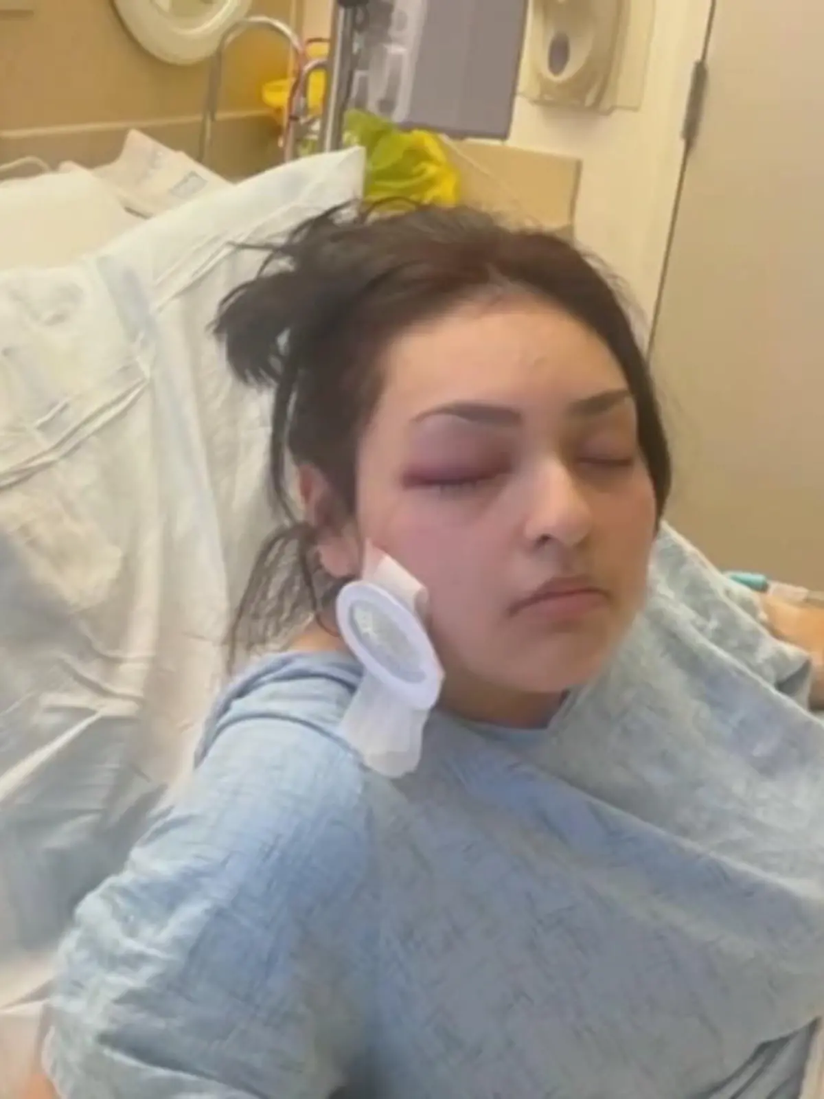 Ein sehr mutiger Schritt, den eine 19-jährige Fast-Food-Mitarbeiterin aus Antioch im US-Bundesstaat Kalifornien machte: Sie verteidigte einen Teenager, den gleich mehrere Männer im Restaurant mobbten. Im Video spricht Bianca Palomera über den Vorfall, nach dem sie tragischerweise ein Auge verlor.