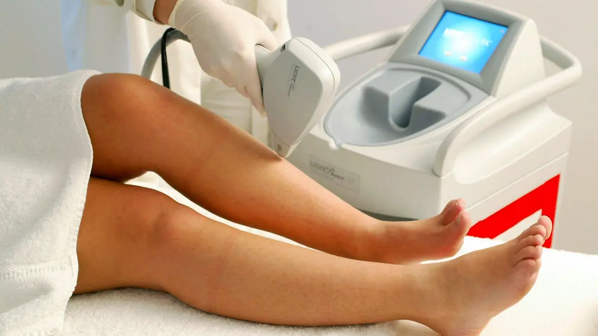Magdeburg (Sachsen Anhalt): An den Beinen einer Frau wird am 19.02.2003 in einem Kosmetiksalon in Magdeburg das Entfernen von Beinhaaren mittels Lasertechnik demonstriert. Wellness-, Fitness- und Beauty-Center sind hoch im Trend. Auch Reisebüros sind längst auf diesen Zug aufgesprungen und werben ganz gezielt für Reisen mit Kurangeboten rund um Schönheit und Wohlbefinden. (MGB473-060302)