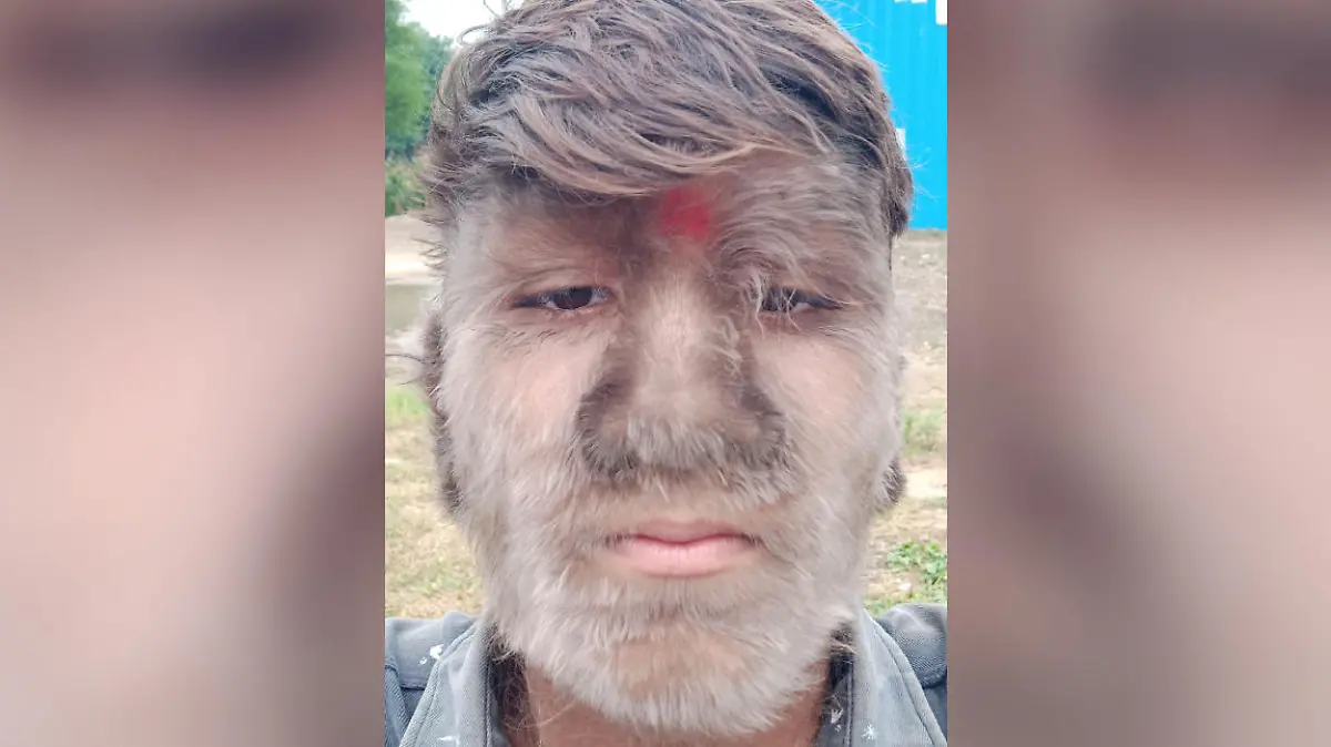 Der 17-jährige Lalit aus Indien