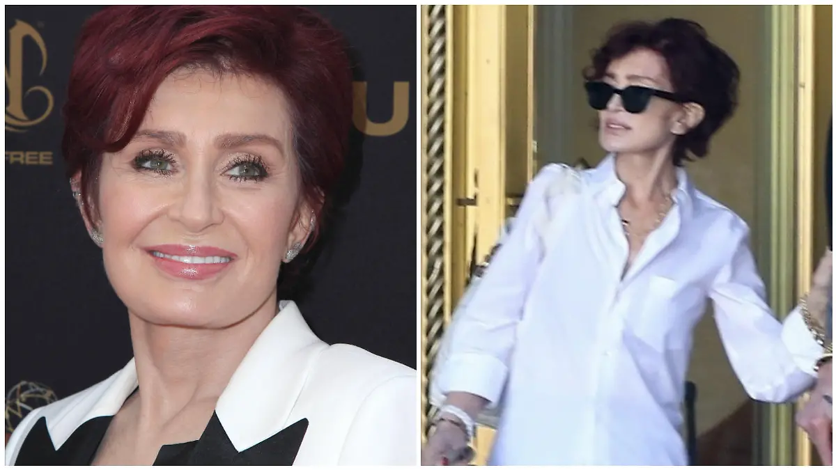 Sharon Osbourne im Vorher-Nachher-Vergleich (Collage)