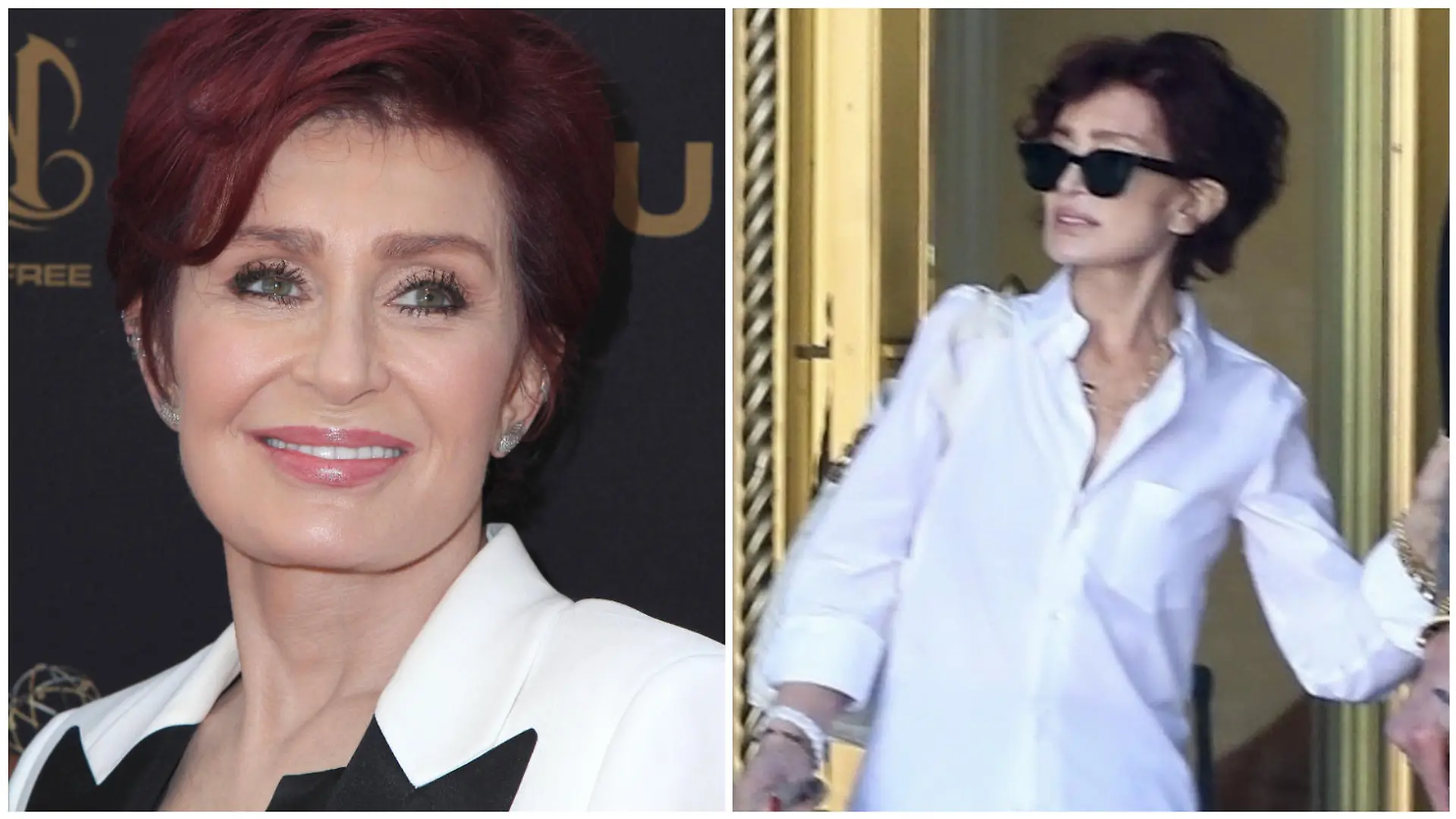 Sharon Osbourne im Vorher-Nachher-Vergleich (Collage)
