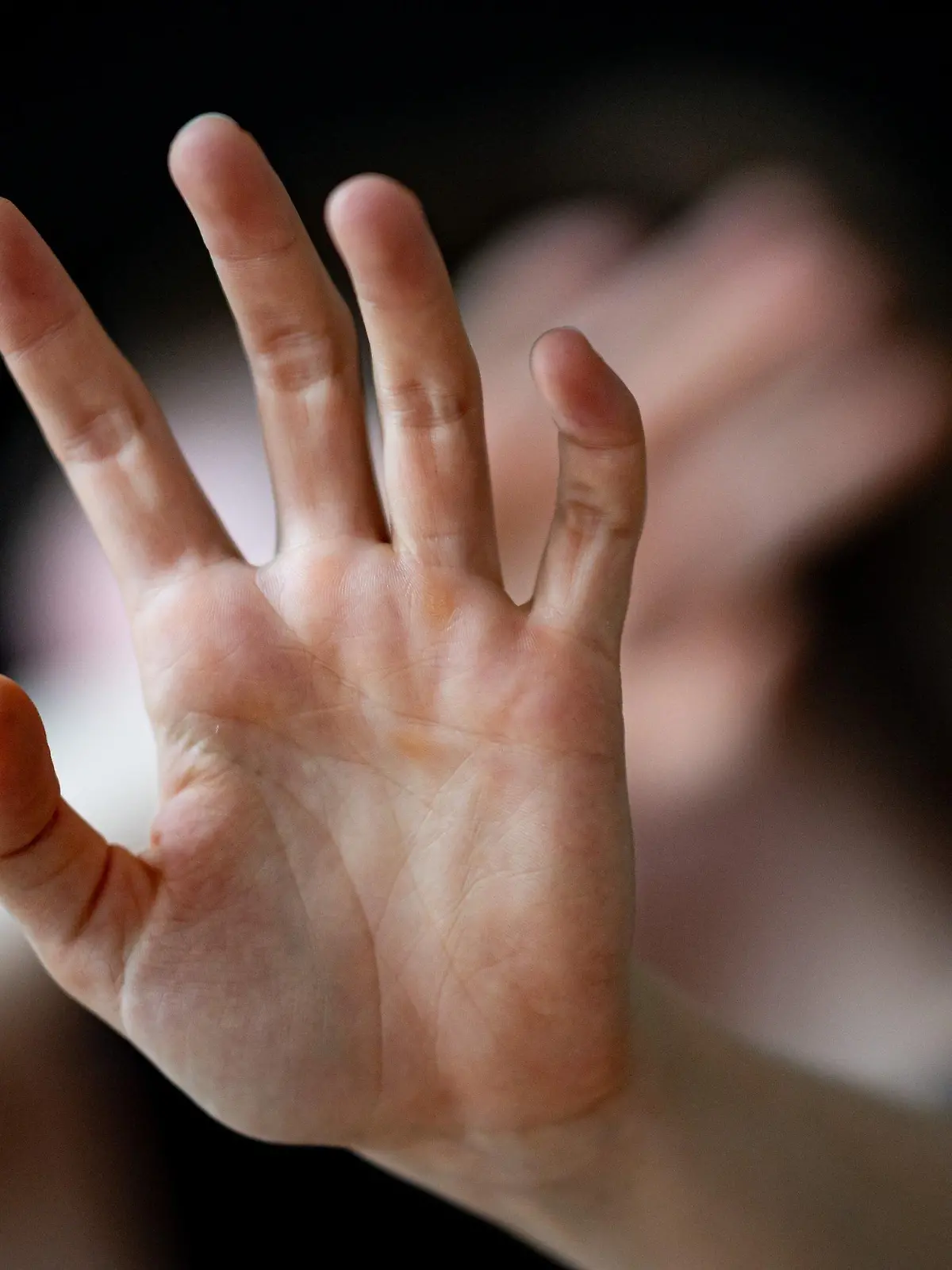 ARCHIV - 01.07.2023, Berlin: Eine Frau hält ihre Hände vor das Gesicht (zu dpa «Fast 2000 Menschen beantragen in NRW Opferentschädigung - zunehmend nach Sexualstraftaten»), (Gestellte Szene) Foto: Fabian Sommer/dpa +++ dpa-Bildfunk +++