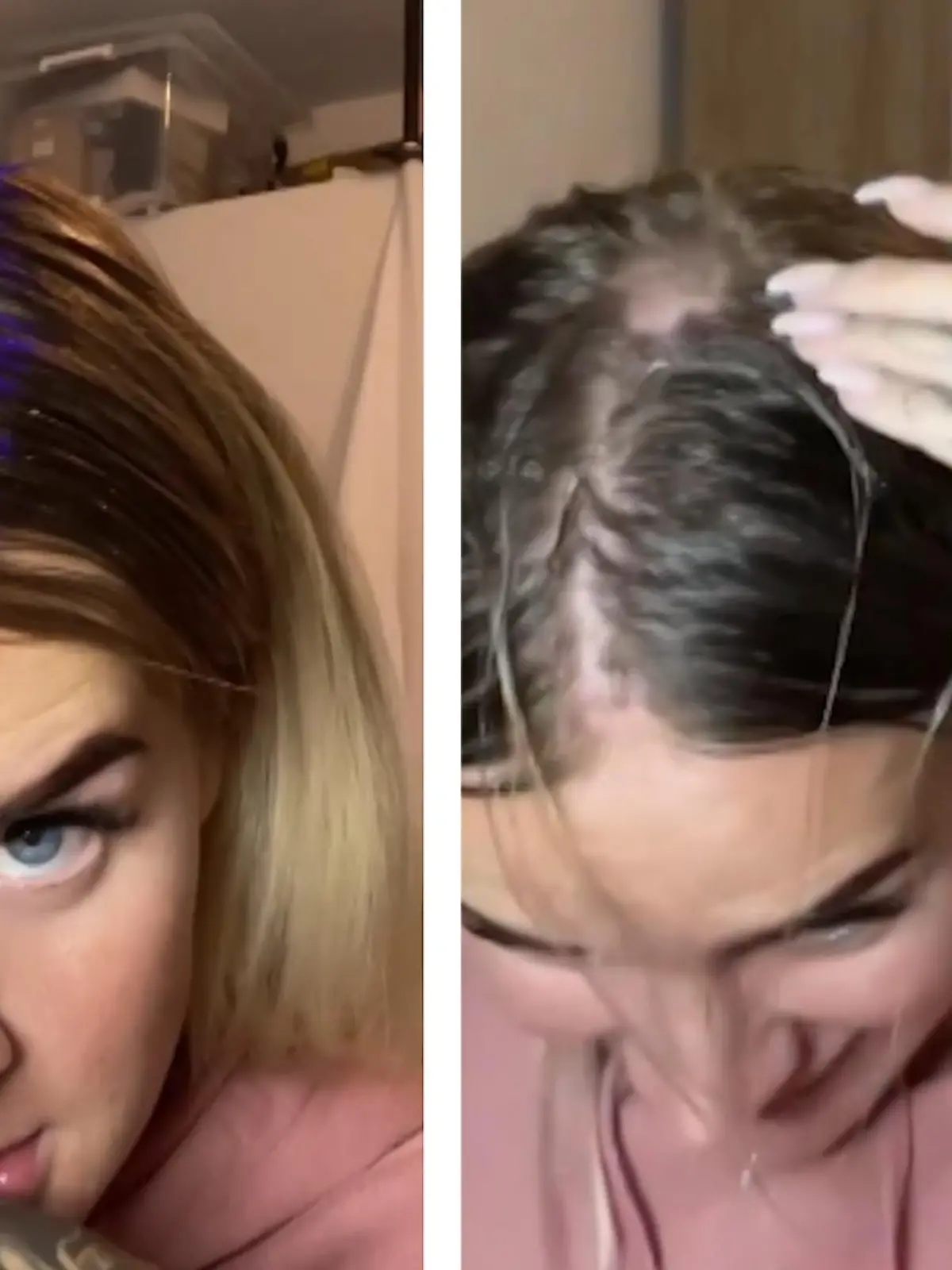 Diesen Haar-Trend hätte Reality-Sternchen Anna Iffländer wohl besser ausgelassen. Jetzt hat sie den Salat, äh die Pläte!