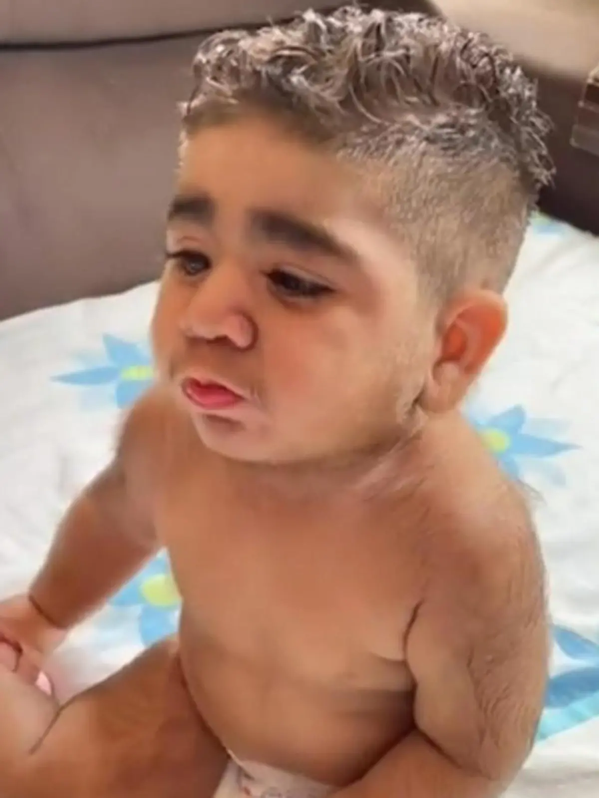 Der kleine Joao Miguel ist am ganzen Körper behaart – und deswegen ein echter Internet-Star! Denn durch seine Körperbehaarung sieht das Baby fast wie ein erwachsener Mann aus. Was dahinter steckt, erfahren Sie im Video.